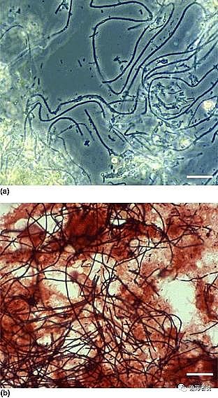 高品質椰殼活性炭廠家膨脹和泡沫的M. parvicella菌的簡述